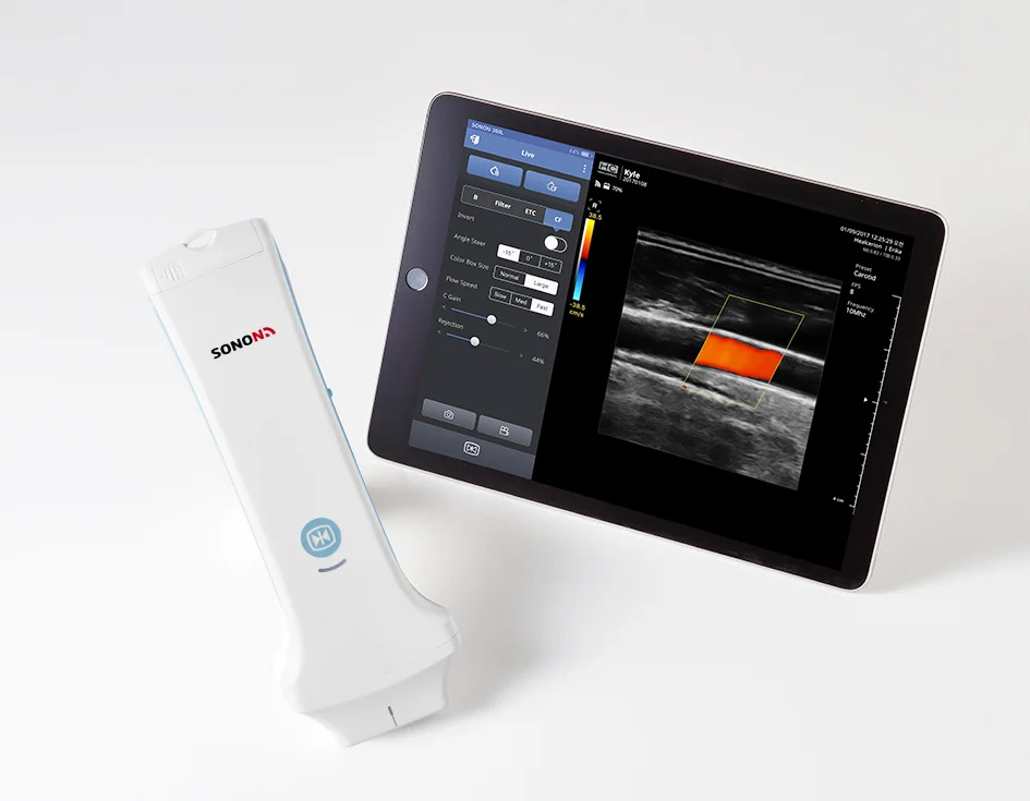Article - What to look for when buying an Ultrasound system